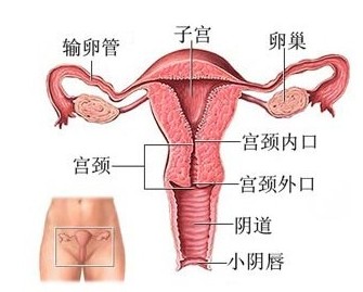 子宫内膜异位症的预防