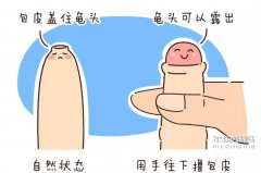 任丘包皮炎是怎么回事？无外乎这5种原因！